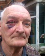 Perry Barr Thief Attack