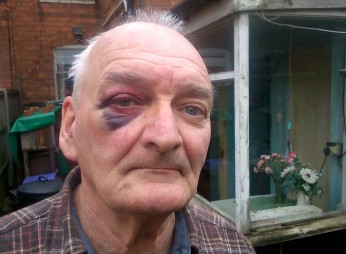 Perry Barr Thief Attack